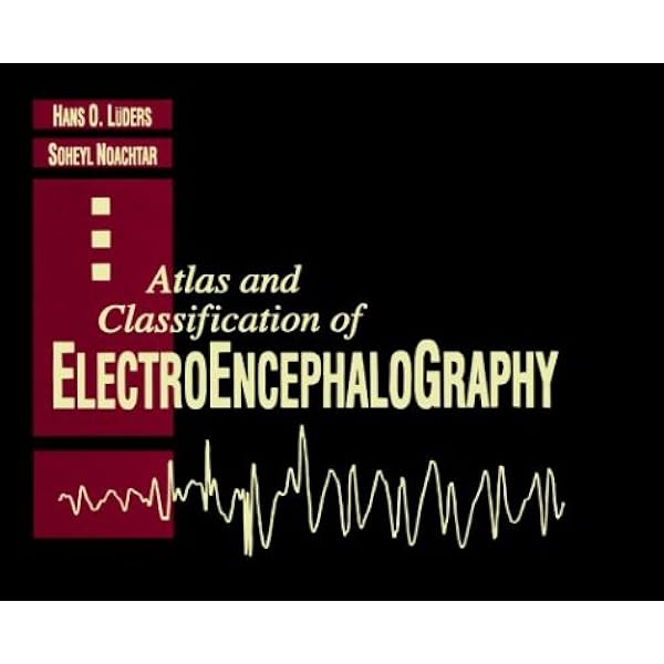 Atlas And Classification Of Electroencephalography 9780721665542 Medicine Health Science Books Amazon Com