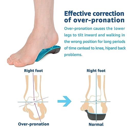 Orthotics Pronated Foot Posture Over Pronation Flat Foot Back Pain