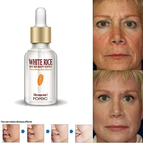 Newkelly Rice Skin Nourishing Essence Nourishing And White Moisturizing Essence