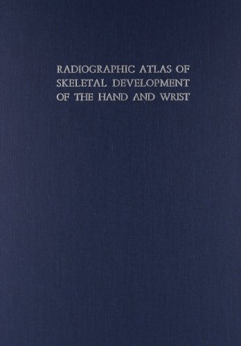 RADIOGRAPHIC ATLAS OF SKELETAL DEVELOPMENT OF HAND AND WRIST-2ND REV ED