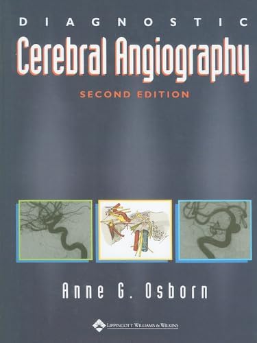 Decision Making in Neurovascular Disease: 9781684200573: Medicine
