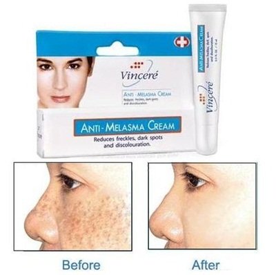 Top Quality VINCERE ANTI-MELASMA CREAM - Help to fade freckles dark spots discoloration -15ml