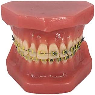 ホームアクセサリー教育モデルシミュレーション歯モデル矯正歯科デモンストレーション用ブレース付きの間違った