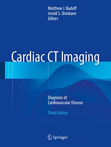 Cardiac CT Imaging: Diagnosis of Cardiovascular Disease