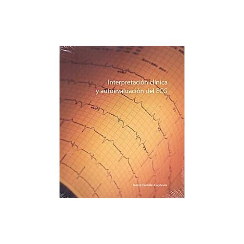 Interpretacion clinica y autoevaluacion del ecg Interpretacion clinica y autoevaluacion del ecg
