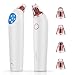 Blackhead Remover, Xpreen Pore Vacuum Rechargeable Pore Cleaner with 4 Multi-Functional Probe, Blackhead Vacuum Especially for Acne,Fett & Facial Pore Clean (White)