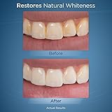 Waterpik Whitening Professional Water Flosser, White