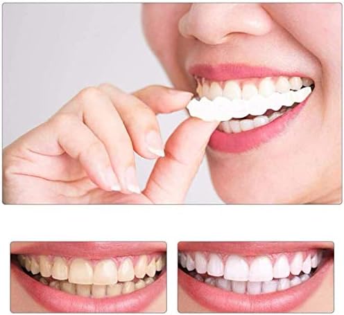 ZXGFA Denture Cover, Temporary Cosmetic Teeth Denture ZXGFA Denture Cover, Temporary Cosmetic Teeth Denture