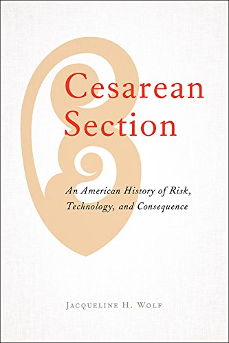 Free Cesarean Section [P.P.T]