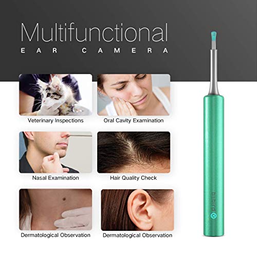 BEBIRD® C3 Ear Cleaner, Ear Wax Removal Tool Wireless Otoscope with