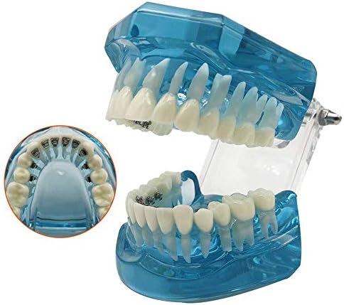 胴体心臓脳スケルトン医科大学教育歯科歯研究教育モデル 歯科矯正モデル 歯のデモンストレーションモデル 歯科口腔内舌側ブラケットモデル ステルス補正