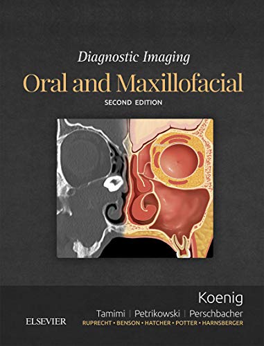 Diagnostic Imaging: Oral and Maxillofacial E-Book - //medicalbooks.filipinodoctors.org
