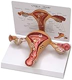Uterus Ovary Anatomical Model With Pathologies