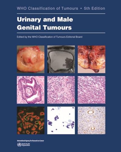 Breast Tumours: WHO Classification of Tumours (Medicine