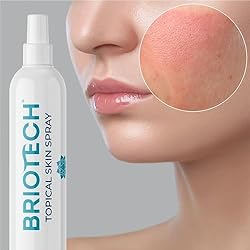 BRIOTECH Topical Skin Spray, Pure Hypochlorous Acid