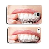teeth with whitening tray cell phone cover case iPhone5