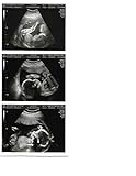Customized 2D PRANK Pregnancy Ultrasound Sonogram Test - Photo Strip of 3 photos