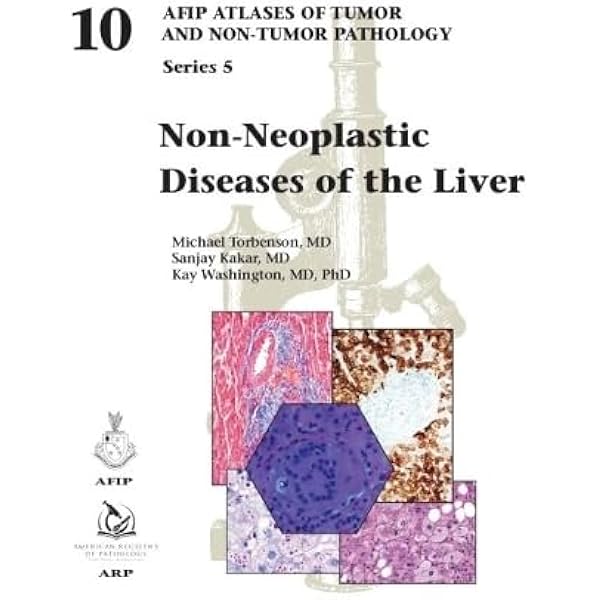 AFIP　Tumors of the Pancreas 【新品】 Tumors of the Pancreas (AFIP Atlases of Tumor and Non-Tumor