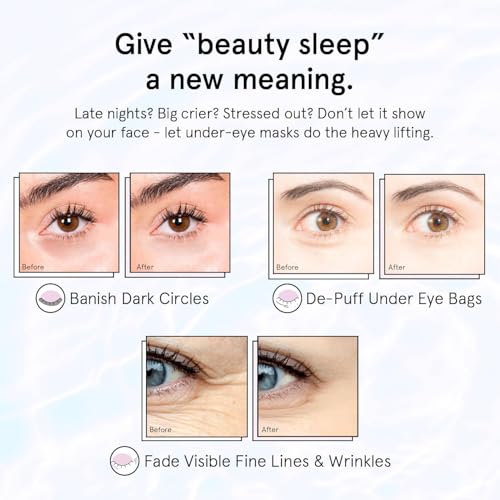 grace & stella Retinol Under Eye Patches for Puffy Eyes and Dark Circles - Restoring Gel Under Eye Masks with Hyaluronic Acid - Vegan Skincare, Self Care Gifts for Women (Purple, 48 Pairs)