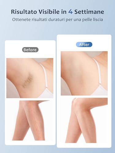 Pulsed Light Epilator with Ice Function 19.35J, Pulsed Light 9 Energy Levels, Automatic Continuous Flash Laser Epilator, Pulsed Light Hair Removal for Women Arms Armpits Legs Body