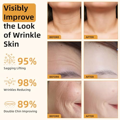 2PCS Bee Venom Firming Serum Stick, Anti-Ageing Facial Lifting Balm, Moisturising & Nourishing Skin Repair, Reduces Wrinkles & Sagging, Improves Skin Elasticity for Face Neck (30g)