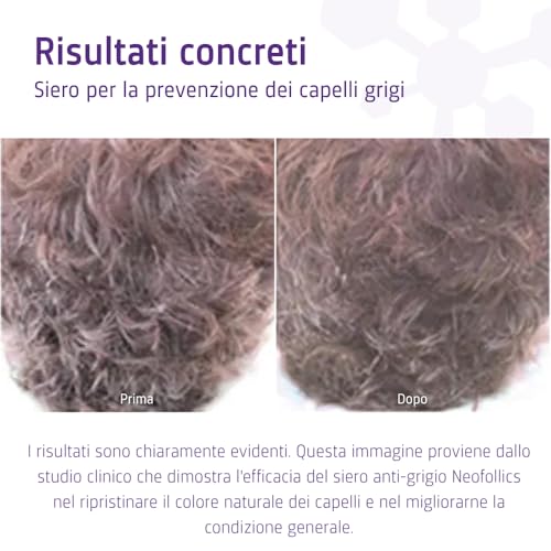 Neofollics Anti Grey Hair Serum - 90ml - Decreases the appearance of grey hair in 90 days - Restores natural hair colour - Nourishes the scalp