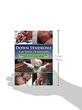 Image de Down Syndrome: The First 18 Months