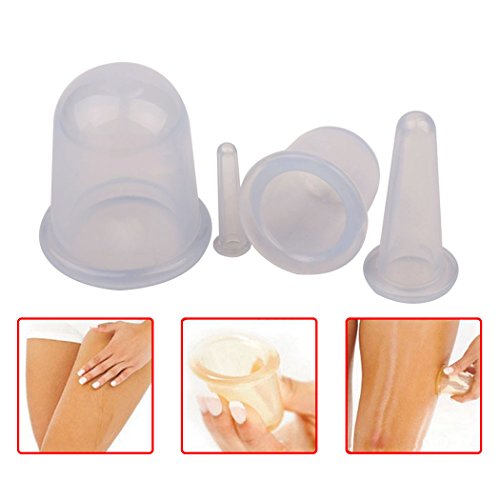inkint 1set/4pcs Modern High Quality Body Ventouses Cups Silicone Cupping Massage Therapy Set Kits for Your Body Facial Eye (White)