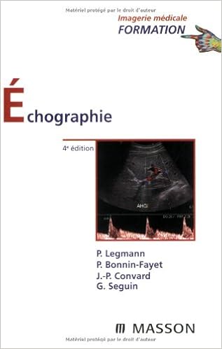 Echographie musculosquelettique French Edition