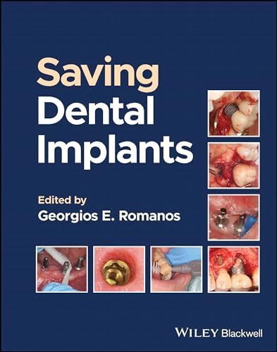 ITI Treatment Guide: Biological and Hardware Complications in