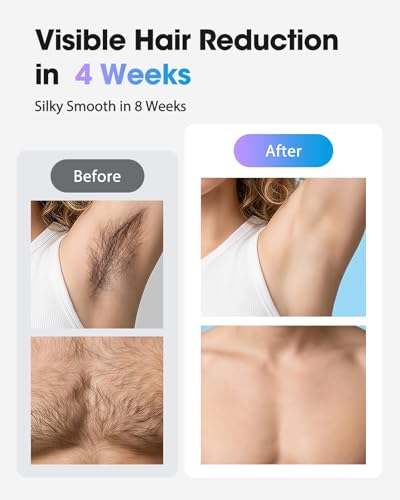 Haarlosy IPL Laser Hair Removal Device for Women and Men with Ice Cooling Painless Salon Quality Result at Home, Lazer Hair Remover for Face Bikini Line Body, 5 Levels, 999,900 Flash Light, Misty Rose