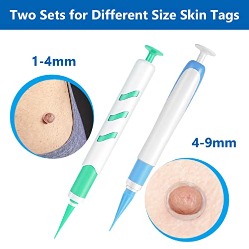 2 Size Automatic Removal Pen Set, Effective, Painless, Easy And Safe For Small To Large Size Warts And Moles (1-9 MM)