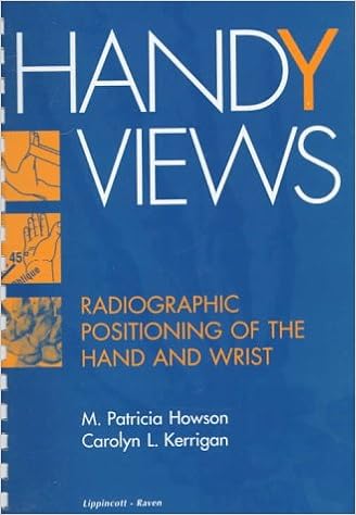 Handy Views Radiographic Positioning Of The Hand And Wrist Howson M Patricia Kerrigan Carolyn L 9781402058905 Amazon Com Books