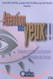 Attention mes yeux !!!