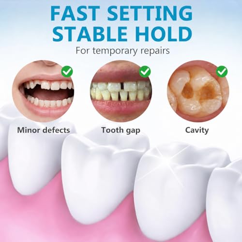 Tooth Filling Repair Kit, Temporary Tooth Filling, Home Use Tooth Repair Kit for Restoring Missing Dentures and Fractured Teeth, Regain Confidence Smile, 1 Count (Pack of 1)