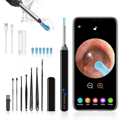 Ohrenschmalz Entferner Otoskop, 1080P Ohrenreiniger mit Kamera, WiFi Ohrreiniger mit Kamera,IP67 Wasserdicht Ohr EndoskopOhrkamera mit 6 LEDs –Otoskop