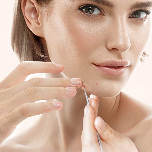 5 Anjou+Blackhead+Professional+Stainless+Extractor