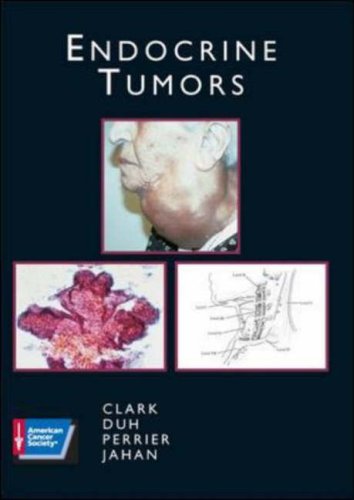 ENDOCRINE TUMORS