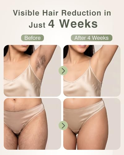 TIIMAGIC IPL Laser Hair Removal Device for Women and Men with Ice Cooling for At Home Use on Upper Lip Underarm Bikini Line and All Body, 9 Level, 999,900 Flash, Auto/Manual Mode, LED Display, White