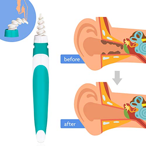 Earwax Removal Kit Earwax Removal Aid & Earwax Cleaning Tool, Safe