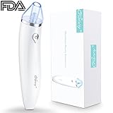 Channy Blackhead Remover Electric, Microdermabrasion Machine, Pore Vacuum Extraction Device, Pimple Extractor, FDA Certified, 3 Intensity Levels with LED Indication, Multifunction, by USB Charging
