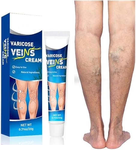 Crème Herbal 30g Pour Varices - Traitement Jambes Lourdes, Action Foncé Sur Les Veines Visibles | Soin Naturel