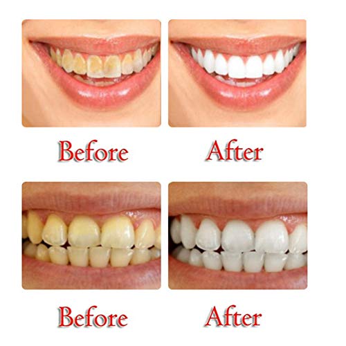 Strengthening Stain Removal Gel Toothpaste Teeth Whitening Toothpaste Fight Bleeding Gums White Toothpaste, Natural, Vegan, Paraben-Free, Anti-Cavity, Pump Packaging (Passion fruit) - Thumbnail 7