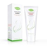 Stretch Marks & Scar Removal Cream for Pregnancy Remove Acne Scars with Natural Herbal Extracts Anti Cellulite and Stretch Marks Remover Massage Safe for All Skin Types
