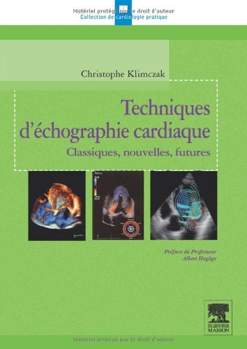 Techniques d'échographie cardiaque