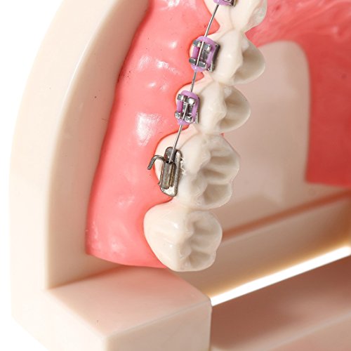 Oral Dentistry Dental Orthodontic Model Teeth Treatment Model with