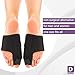 Bunion Splints & Bunion Corrector - Bunion Brace for Hallux Valgus Bunion Pain Relief - No Surgery Bunion Splint - Corrector Bunion
