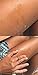 Psoriasis Body Serum | Soften Body Serum | Helps to soften the thickest psoriasis dry skin, scales and soothe dry, cracked or parched skin with vitamin rich emollients