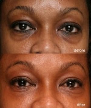 skin nutritions eye serum