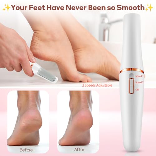 Electric Callus Remover for Feet, Professional Rechargeable Foot File Kit for Hard Dead Dry Cracked Skin Heels Care,Effective Pedicure Tools with Replacement Roller Heads Storage Bag